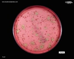 alpha and gamma hemolysis on blood agar